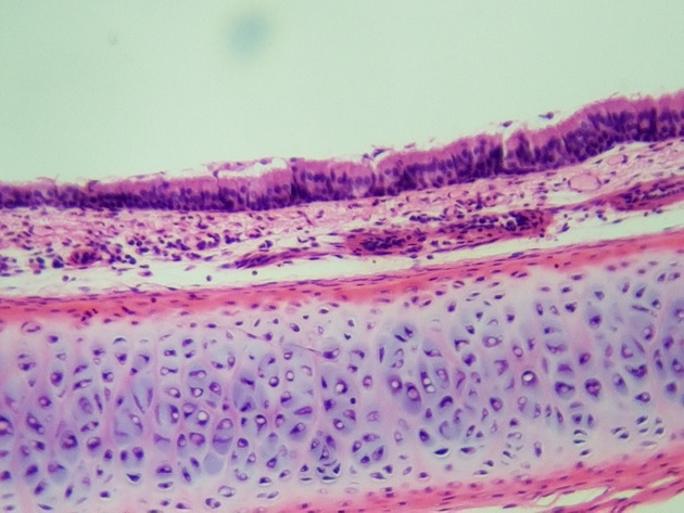 Pseudostratified Epithelium Slides - Pseudostratified Epithelium 07 100X